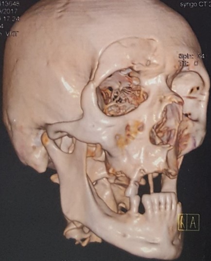 Cirugía Maxilofacial Lanús | Consultorio Odontológico y Médico | Dr. Diego Gastón Camaly | Dra. Amorina Haydée Ortega